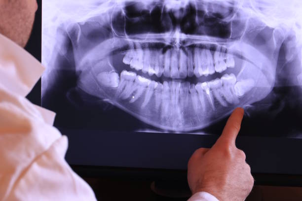 Best Dental Emergency Near Me  in Wonder Lake, IL