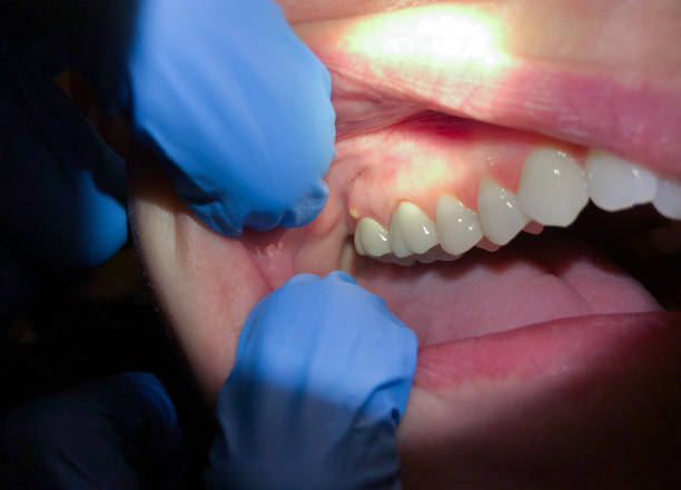 Best Cracked Tooth Emergency Dentist  in Wonder Lake, IL